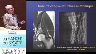 Tendinite psoas et moyen fessier et sport Extrait Dr Meyer Rhumatologue journée SMATSH [upl. by Guidotti]