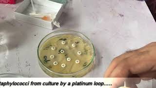 Coagulase positive test  Staphylococcus aureus [upl. by Adnocahs857]