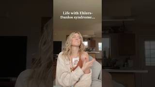 EhlersDanlos Syndrome [upl. by Lenoyl]