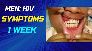 HIV symptoms in men after 1 week [upl. by Kailey52]