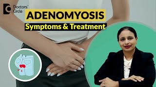 Heavy Painful Periods Adenomyosis of UterusSymptoms amp Treatment DrRashmi Yogish Doctors Circle [upl. by Nylrac]