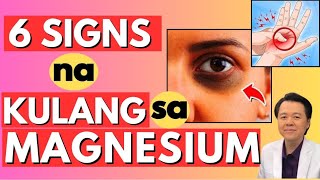 6 Signs na Kulang sa Magnesium  Payo ni Doc Willie Ong Internist and Cardiologist [upl. by Ecnerrot239]