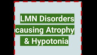 LOWER MOTOR Disorders causing Atrophy amp Hypotonia [upl. by Derfla]