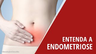 Entenda a Endometriose [upl. by Sanbo209]