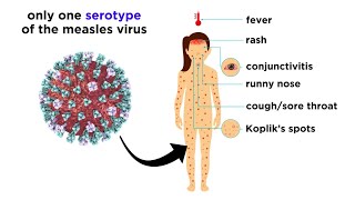 Measles Genus Morbillivirus [upl. by Aracat454]