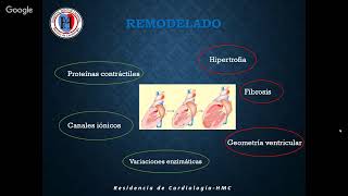 INSUFICIENCIA CARDÍACA FISIOPATOLOGÍA [upl. by Kendre]