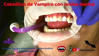 Colmillos de vampiro de resina dental 🧛 [upl. by Karon]