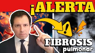 ALERTA ⚠️ CIENTÍFICOS REVELAN QUE INCIDENCIA DE FIBROSIS PULMONAR INCREMENTARÍA POR COVID19 [upl. by Maher]