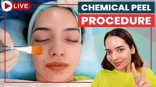 CHEMICAL PEELS Step by Step  Acne Scar Treatment in Delhi  Chemical Peeling Treatment Dr Jangid [upl. by Aynatahs]