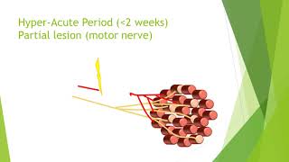 Nerve damage and repair [upl. by Durtschi]