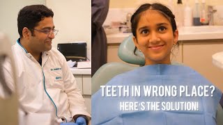 TEETH IN WRONG PLACE How To Fix dentist shortsindia [upl. by Eiroj545]