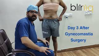 Patient Review on Day 3 After Gynecomastia Surgery [upl. by Lichtenfeld722]