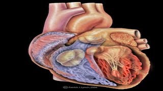 Angiogram and Angioplasty live Video  Coronary angiogram full length procedure MST RASHIDA BEGUM [upl. by Noll]