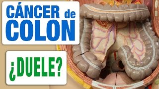 Cáncer de Colon y Dolor [upl. by Garlanda]