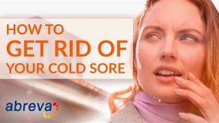 How To Get Rid of a Cold Sore  Abreva® [upl. by Doralin]