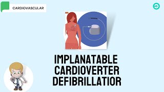 ICD Implantable Cardioverter Defibrillator [upl. by Epul]