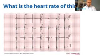 FB Live EKG Sinus Arrhythmias by Mobeen Syed MD [upl. by Ellerred]