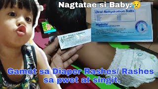 Gamot sa Rashes sa pwet at singit ni Aleph Diaper Rash Gamot sa pagtatae ni Baby [upl. by Penthea]