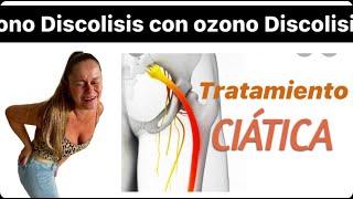 Ciatica y ozonoterapia [upl. by Rowen26]