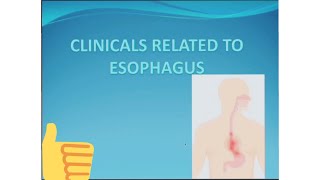 CLINICLALS RELATED TO THE ESOPHAGUSBarium swallowAchalasia CardiaDysphagiaEsophageal carcinoma [upl. by Tadeo]