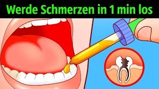 10 Möglichkeiten Zahnschmerzen in einer Minute loszuwerden [upl. by Ahterod]