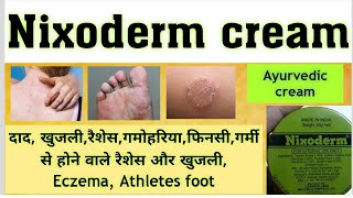 nixoderm cream nixoderm cream uses in hindinixoderm cream ayurvedic  पूरी जानकारी हिंदी में [upl. by Gallenz265]