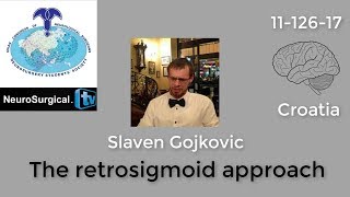 Slaven Gojkovic The retrosigmoid approach [upl. by Hali497]