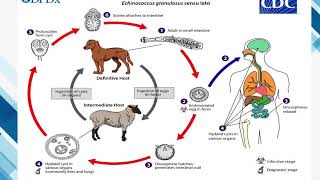 Echinococcus granulosus QFB Orizaba [upl. by Amalita]