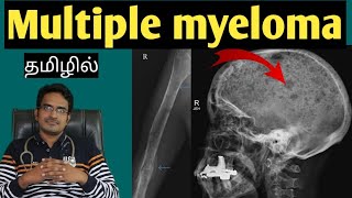 multiple myeloma in tamilmedical awareness in tamil [upl. by Wendt150]