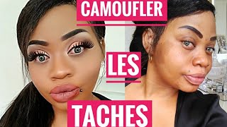 ❤ CAMOUFLER les TACHES d HYPER PIGMENTATION❤ DÉPIGMENTATION ACNE [upl. by Tabitha]