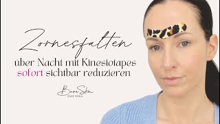 Zornesfalten über Nacht reduzieren mit Kinesiotapes  so gehts [upl. by Effy]