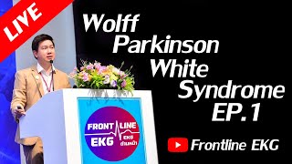 Live WolffParkinsonWhite Syndrome Part 1 [upl. by Pauli]