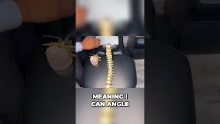 C5C6 Disc Bulge Treatment How Spinal Decompression Works  Dr Ruminder Birk [upl. by Eyeleen]