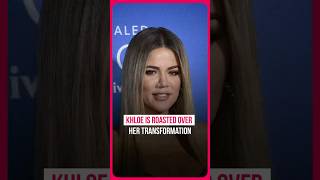 Khloe Kardashian faces backlash 💉 [upl. by Ainoek]