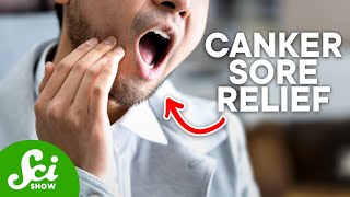 How to Get Rid of Canker Sores According to Science [upl. by Turnheim]