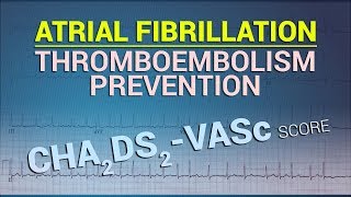 Thromboembolism Prevention in Atrial Fibrillation  CHA2DS2VASc Score [upl. by Cid]