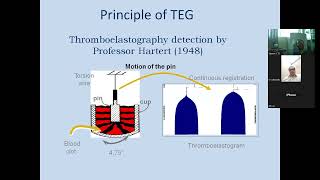 Rotational Thromboelastometry ROTEM [upl. by Colman]