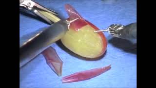 People doing Surgery on a grape for 10 hours [upl. by Anibor]