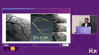 How do I confidently expand my DCB practice  EuroPCR 2024 [upl. by Mackenie466]