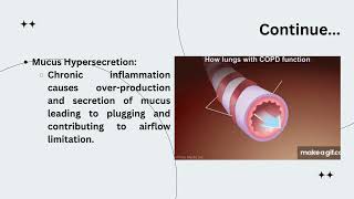 What is COPD its Etiology Pathophysiology Symptoms And Treatment [upl. by Eniawd26]