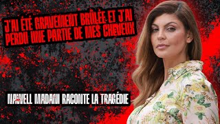 Nawell Madani raconte la tragédie Jai été gravement brûlée et jai perdu une partie de mes cheveux [upl. by Oglesby187]