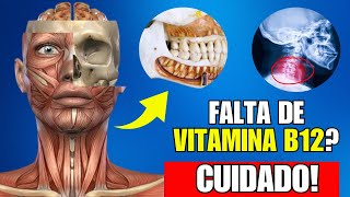 Nunca Ignore esses 10 Sintomas de Deficiência de Vitamina B12 [upl. by Etrem]