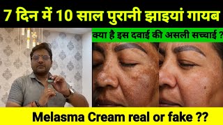 Pigmentation removel cream  pigmentation treatment on face [upl. by Deana]