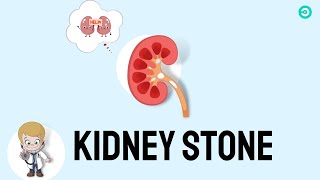 kidney stone Formation symptoms Diagnosis amp Surgical Treatment options [upl. by Ahsircal969]