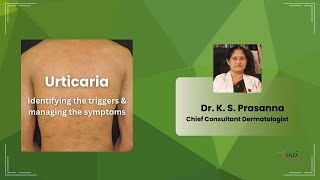 Urticaria  Identifying triggers amp managing symptoms  Integrated Medicine for Skin Diseases  IAD [upl. by Edialeda]