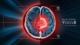 Brain Tumors Detection [upl. by Joselow]