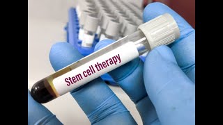 My Stem Cell Therapy Experience  October 2024 [upl. by Simons180]