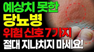 절대 놓치지 마세요 모른다면 후회할 당뇨병의 위험한 7가지 증상은 당뇨병에 나쁜 음식과 좋은 음식 총정리 [upl. by Rebekah]