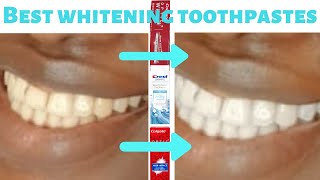 Best toothpaste for whitening A Dentists guide tried and trusted [upl. by Hege]