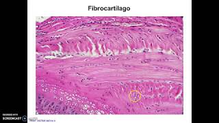 Clases Tejido Cartilaginoso parte III [upl. by Gilcrest]